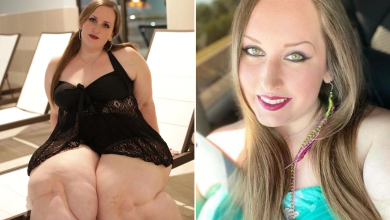 I Was Shamed for My Weight by Doctors Then a Stranger Revealed the Truth to Me