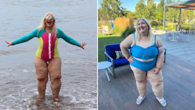 This Woman Had the Perfect Response After Being Shamed for Her Loose Skin