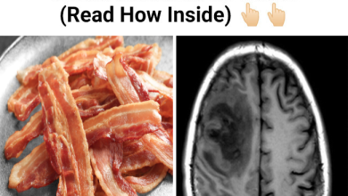 Worm Eggs Found in Mans Brain After Migraines Undercooked Bacon Identified as Cause