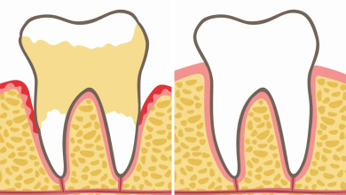 Dentists Explain 7 Habits That Can Harm Your Teeth and Gums