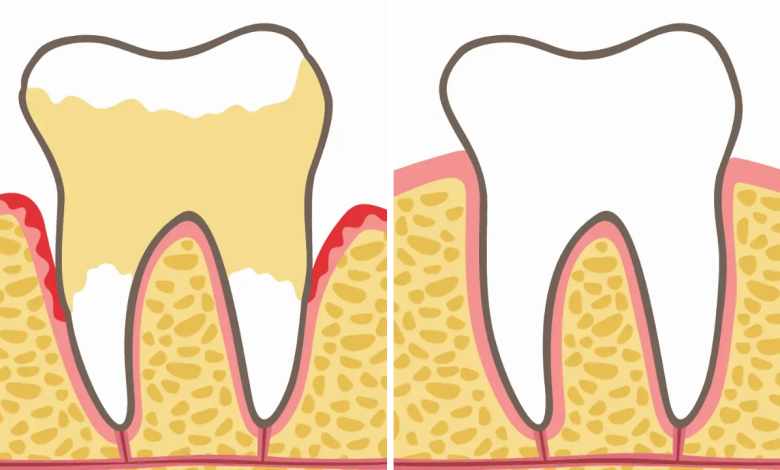 Dentists Explain 7 Habits That Can Harm Your Teeth and Gums