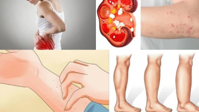 If Your Kidney Is in Danger the Body Will Give You These 8 Signs3