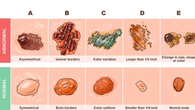 This skin cancer detector guide can save your life e1729567066586