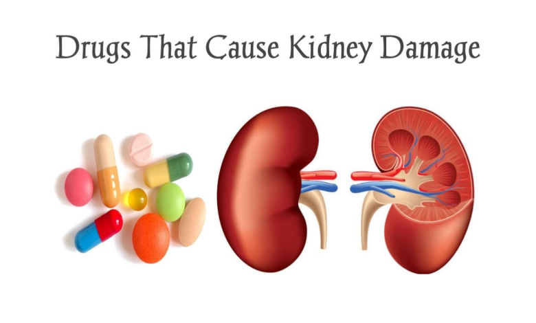 Top Ten Drugs That Cause Kidney Damage Please Do Not Ignore This